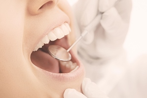 Zahnarzt untersucht mit Spiegel die Zähne einer Patientin im Close-up